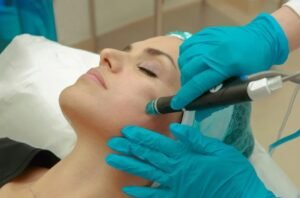 Over-the-Counter Treatments for Dark Spots